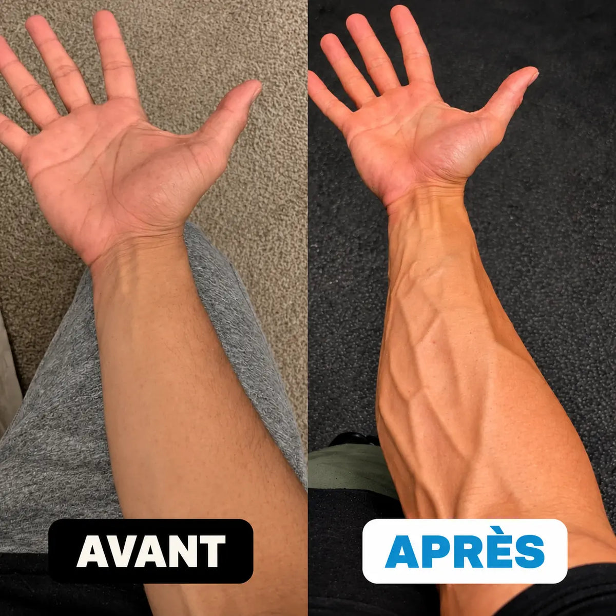 Alémence GripX™ — Renforceur de mains & avant-bras