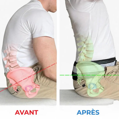 Ceinture Sacro-Iliaque