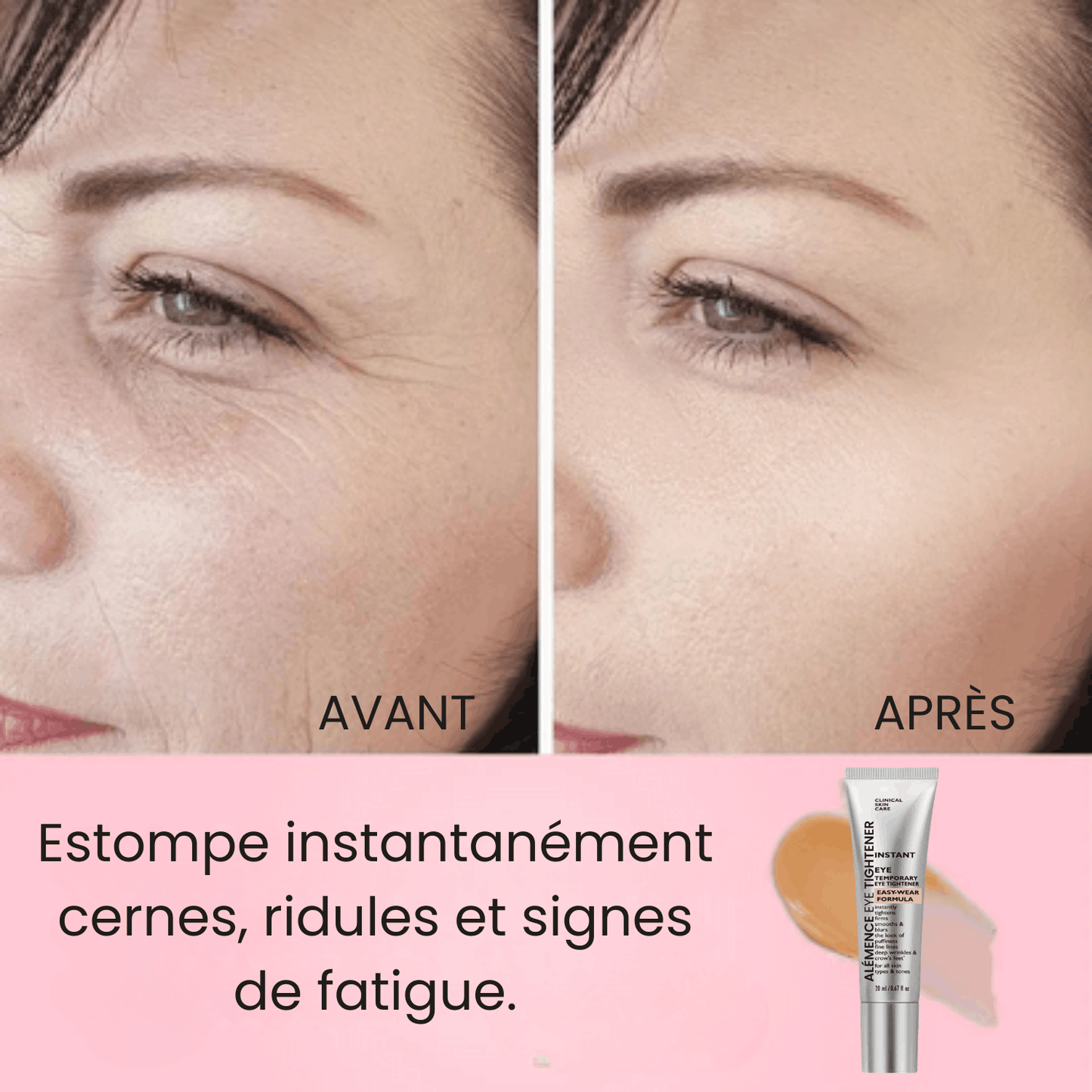 Regard Lift