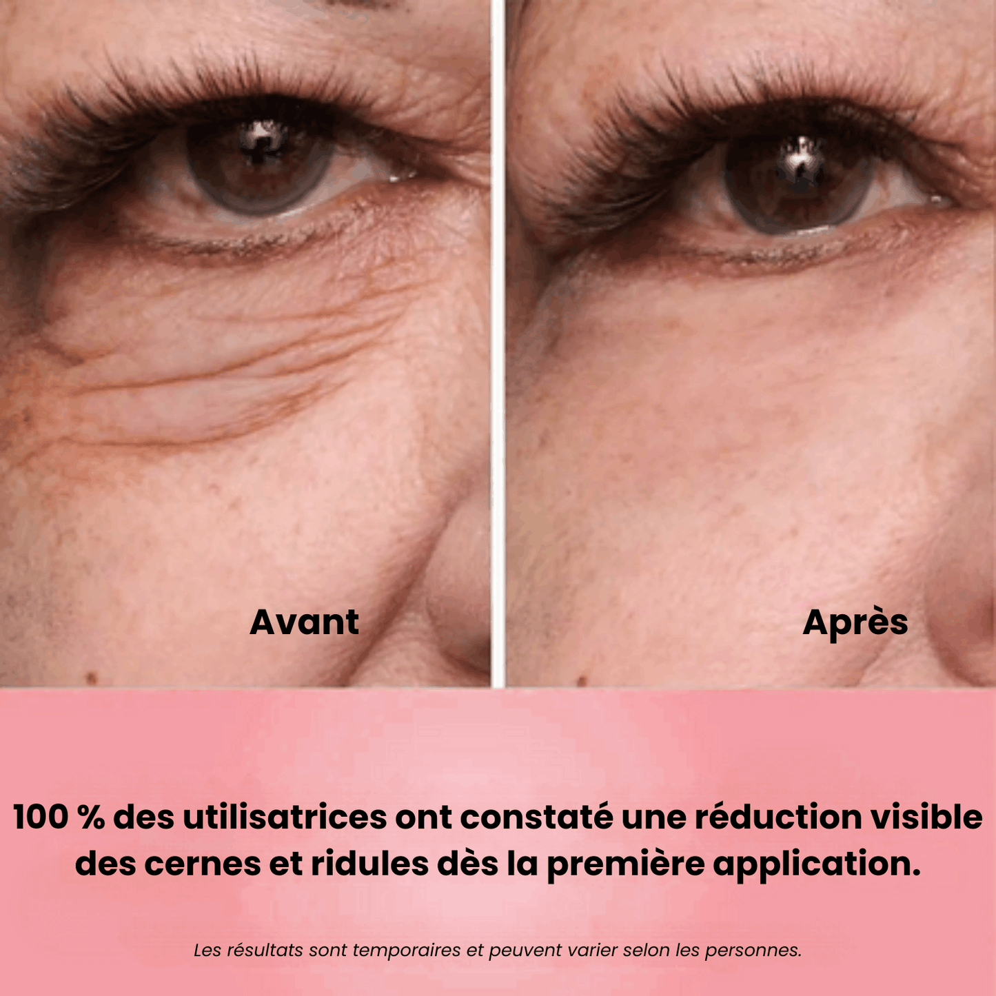 Regard Lift