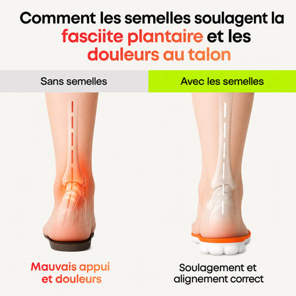 Semelles orthopédiques – Soulagement du talon et de la fasciite plantaire
